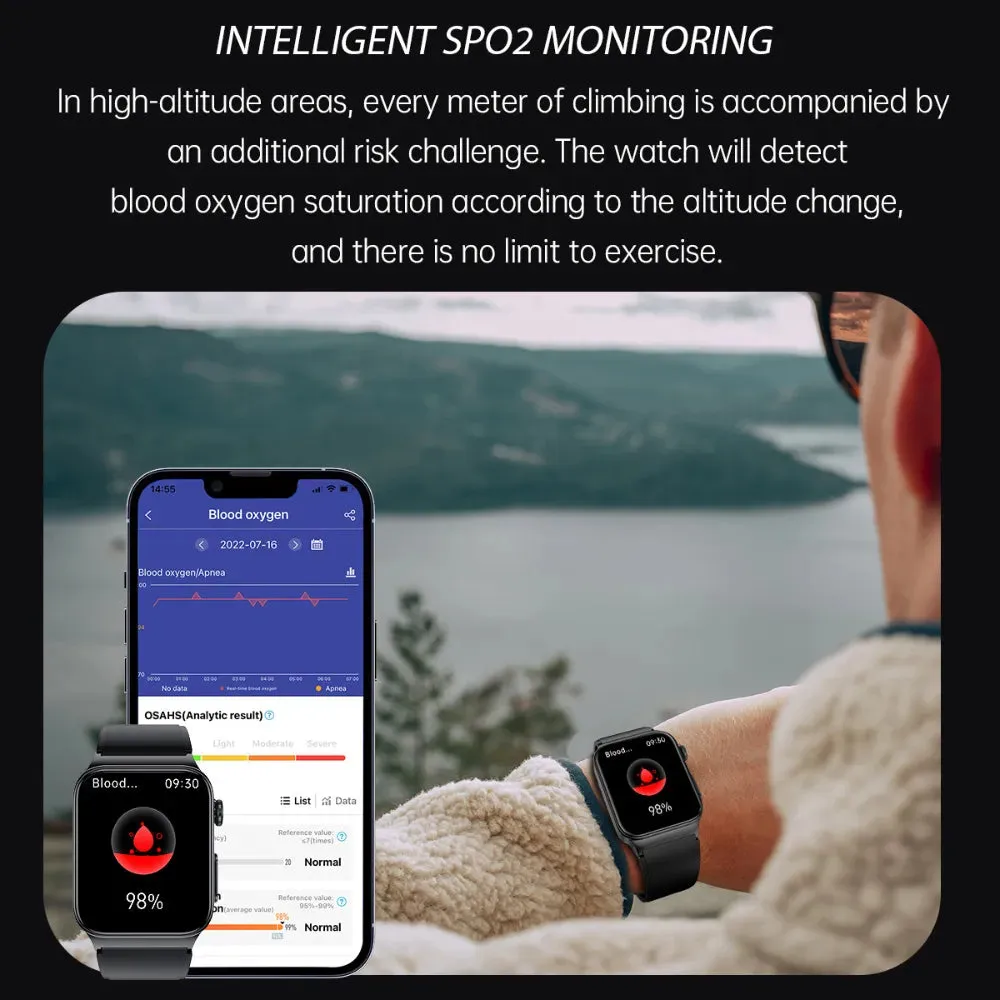 XIAOMI E500 Blood Glucose Smartwatch Electrocardiogram Temperature Blood Oxygen Sleep Monitoring ECG PPG Sports Smart Watch